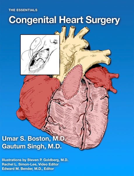 Book Review - The Essentials: Congenital Heart Surgery | CTSNet